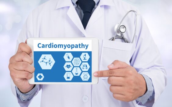 Identify Symptoms - HOCM