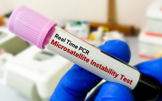 Identify Symptoms - MSI-H