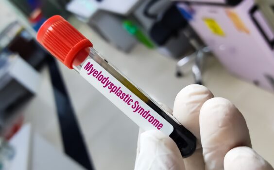 Identify Symptoms - MDS Cancer